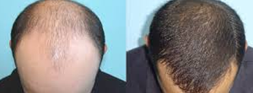 Dr.Suresh Cosmetic Surgery